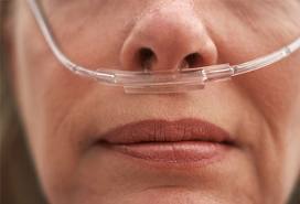 Nasal Cannula
